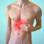 Dormire sul lato sinistro: l’errore che peggiora il reflusso (ecco come dovresti fare)