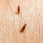 Invasione di pulci in casa o sugli animali pianta subito queste per tenerle lontane