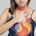 Allerta reflusso: i cibi che lo peggiorano
